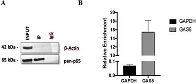 The long non-coding RNA GAS5 contributes to the suppression of inflammatory responses by inhibiting NF-κB activity